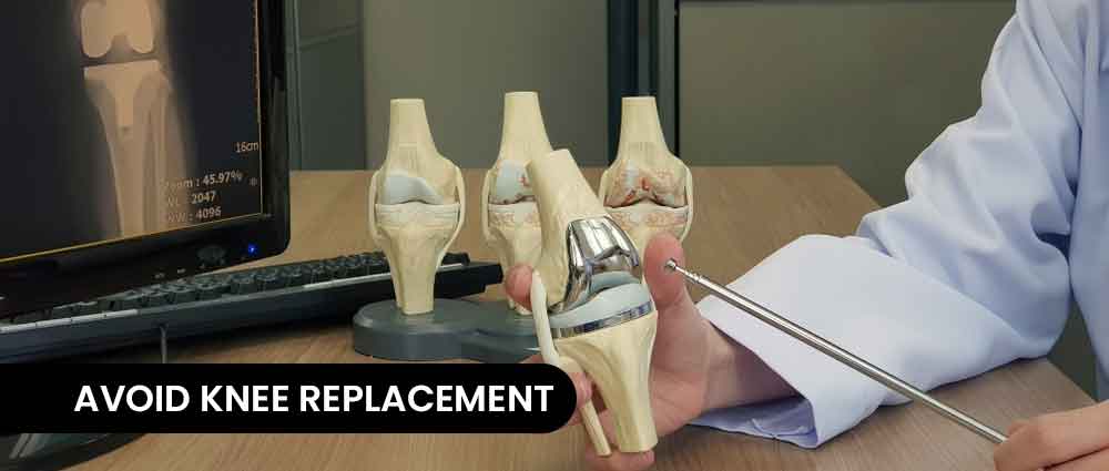 avoid knee replacement